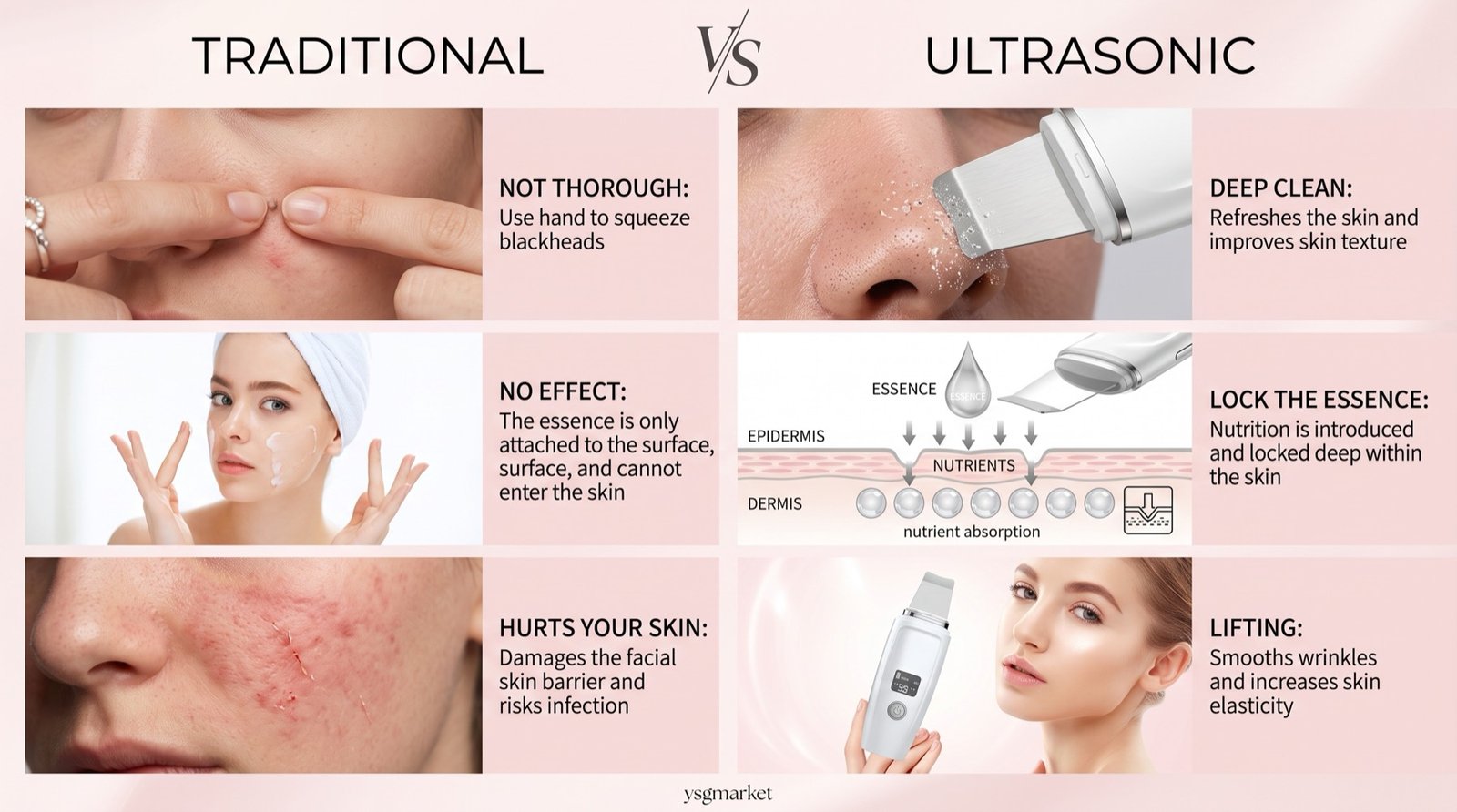 Traditional blackhead removal compared with ultrasonic cleansing